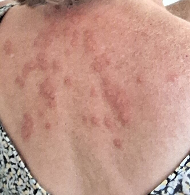 彭赫斯特酒店主图