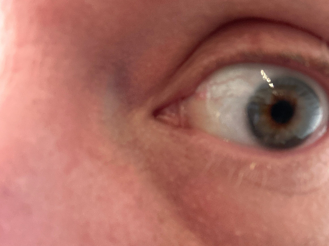 Eyemazy Amsterdam-阿姆斯特丹必去景点