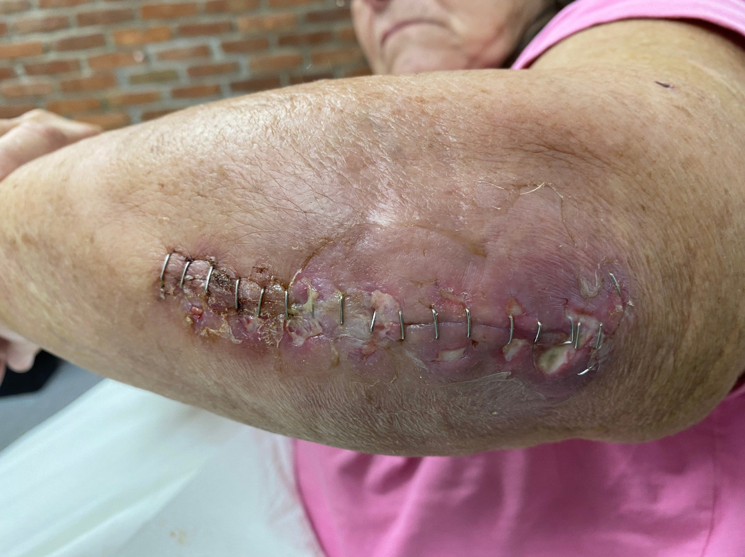 Comfort Suites Marietta Parkersburg主图