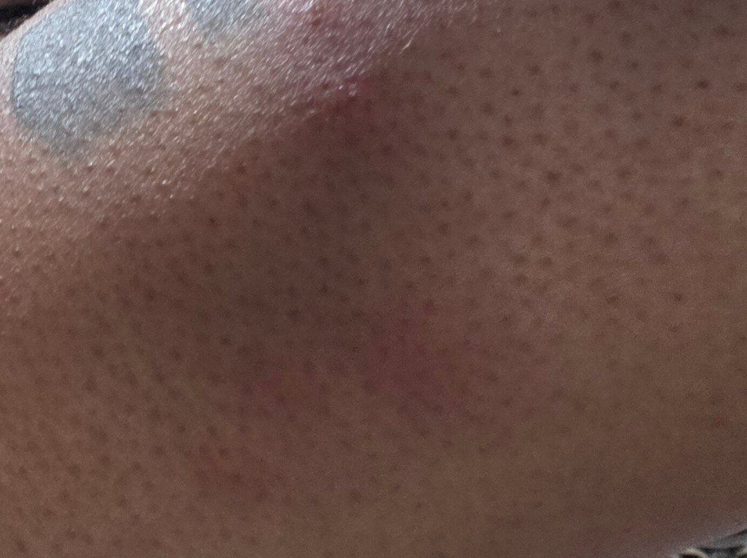 The Palms At Coco Beach主图