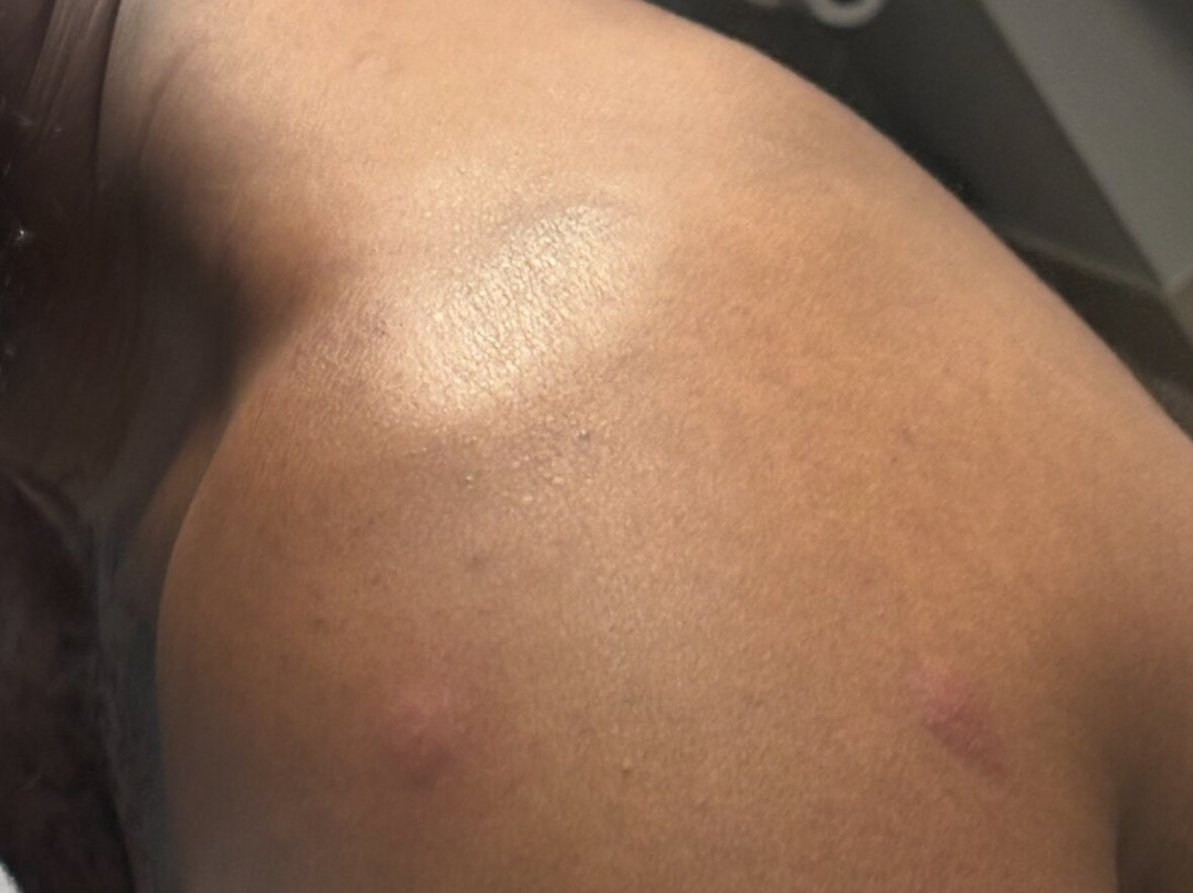 智选假日套房酒店阿比林主图