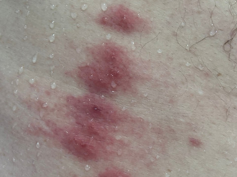 位于奥尔伯里的18卧室公寓-平方米|带18个独立浴室主图