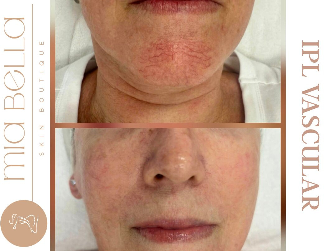 Mia Bella Skin Boutique-Buddina必去景点