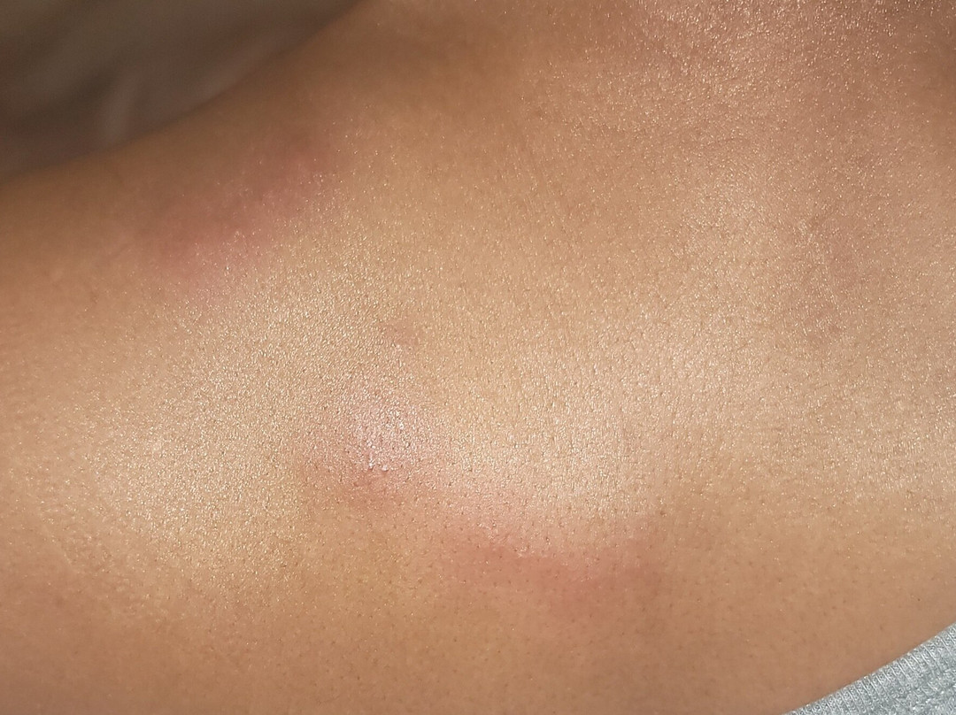 Embassy Suites by Hilton Berkeley Heights主图