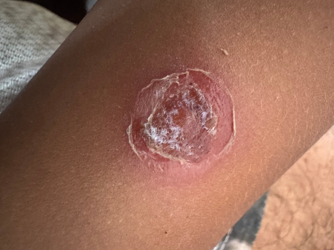 Laguna El Dudu-Cabrera必去景点