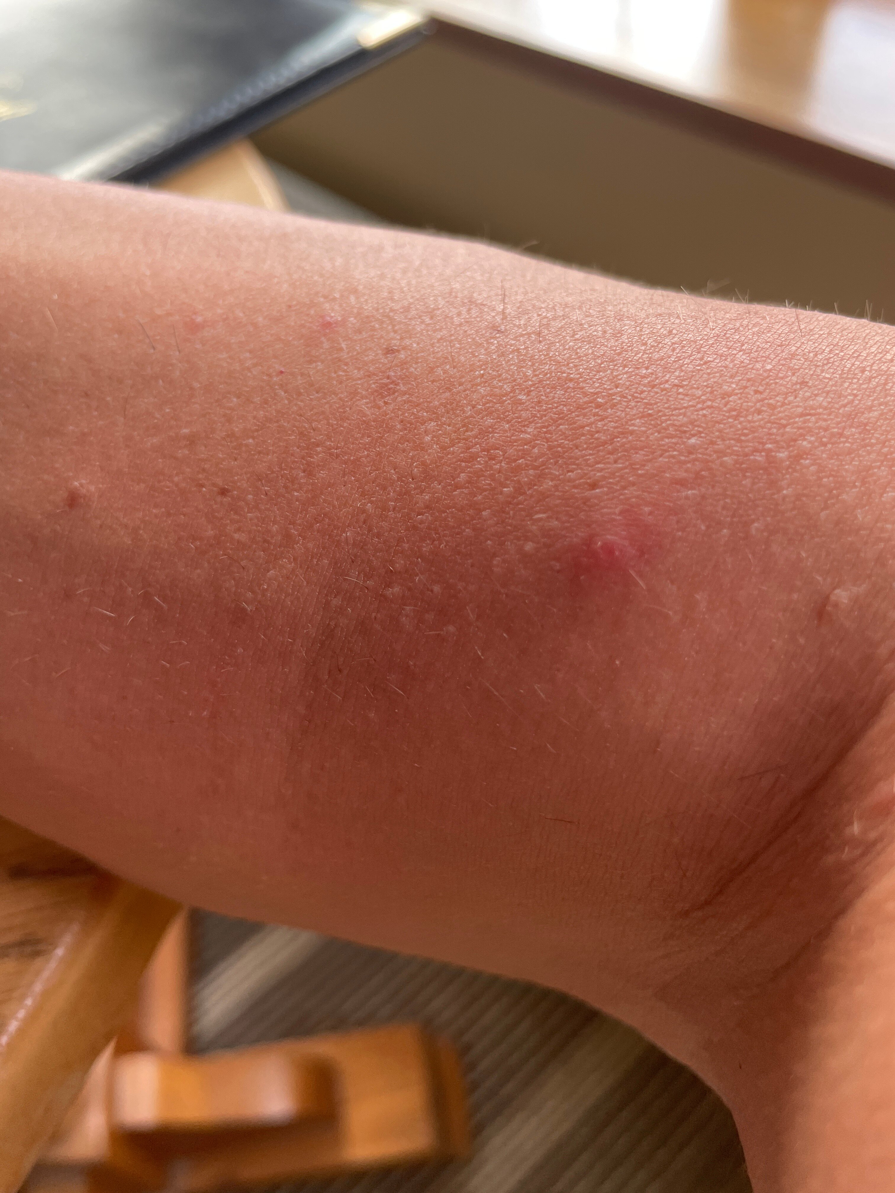 萨尔瓦多特雷沃尔公寓-官方