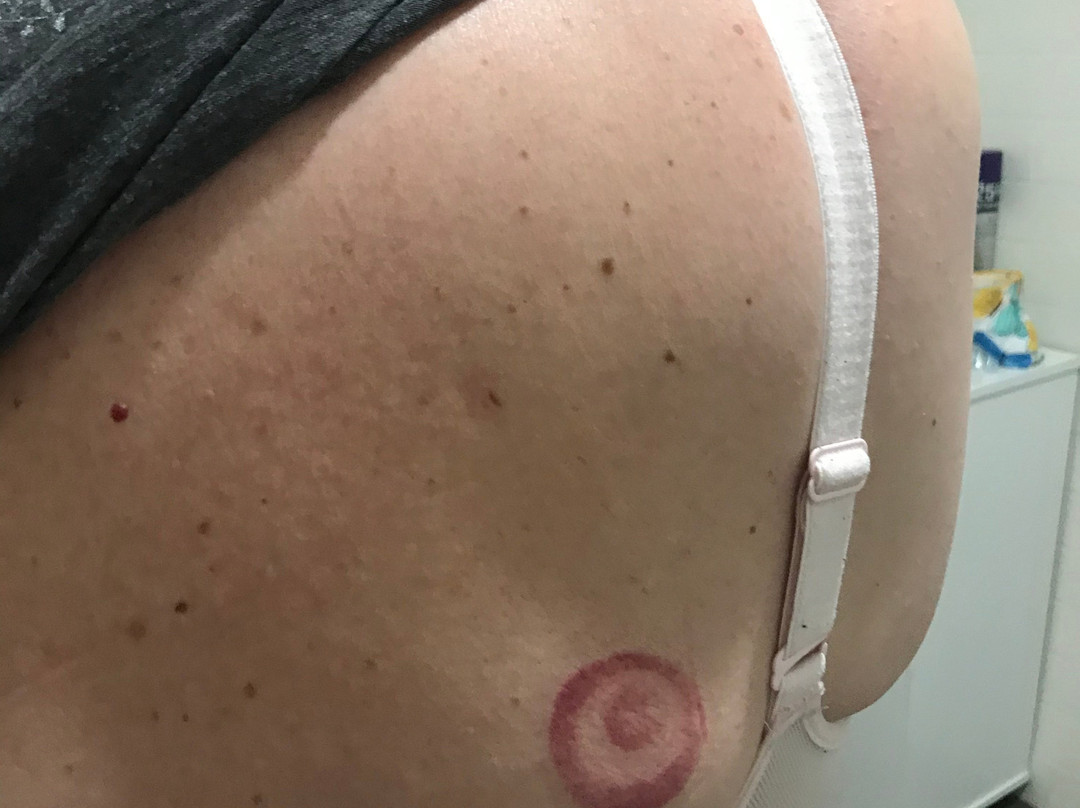 Huskisson Beach B&B主图