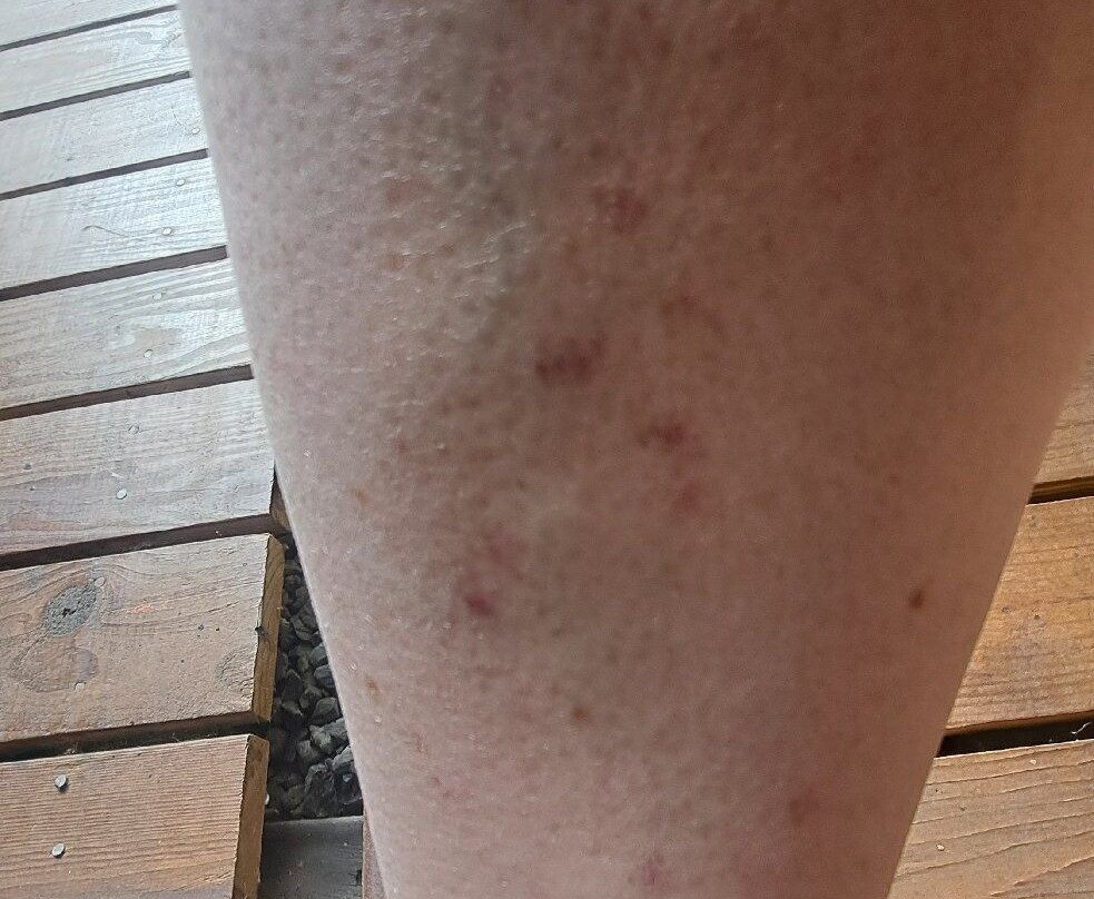 布拉德福德智选假日酒店主图