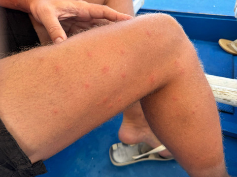 费尔勒海滨酒店主图