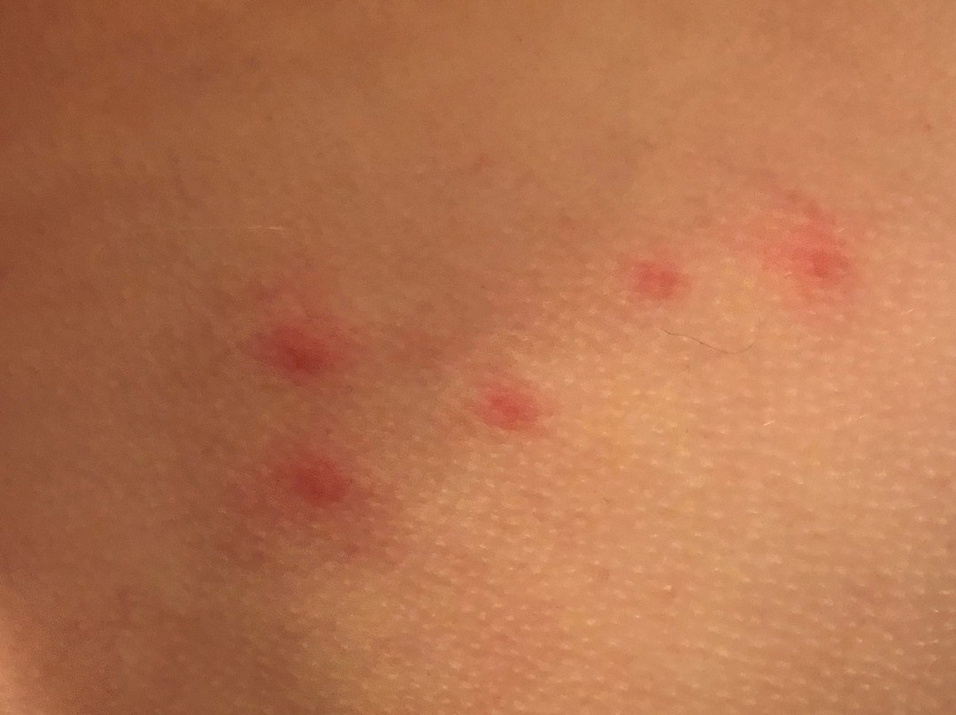 Teewinot Lodge主图