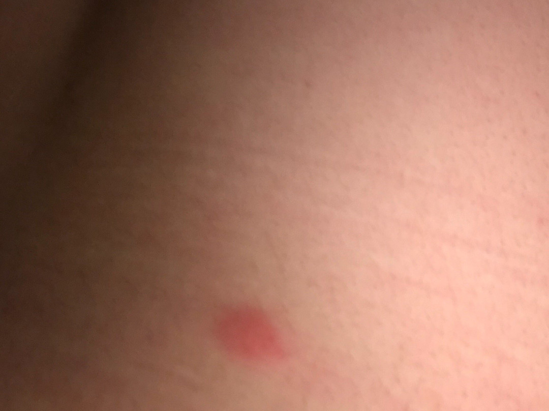 Fairfield Inn & Suites Denver Aurora/Medical Center