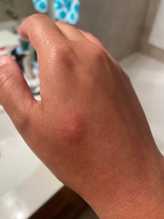 Ocean's Edge Hotel, Port Aransas TX主图