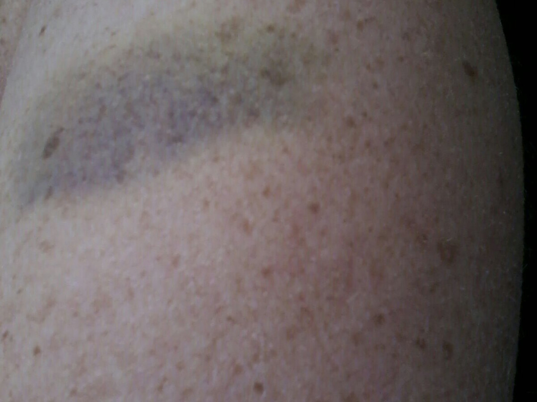 Bosc Tancat-塞尔达尼奥拉德尔瓦列斯必去景点