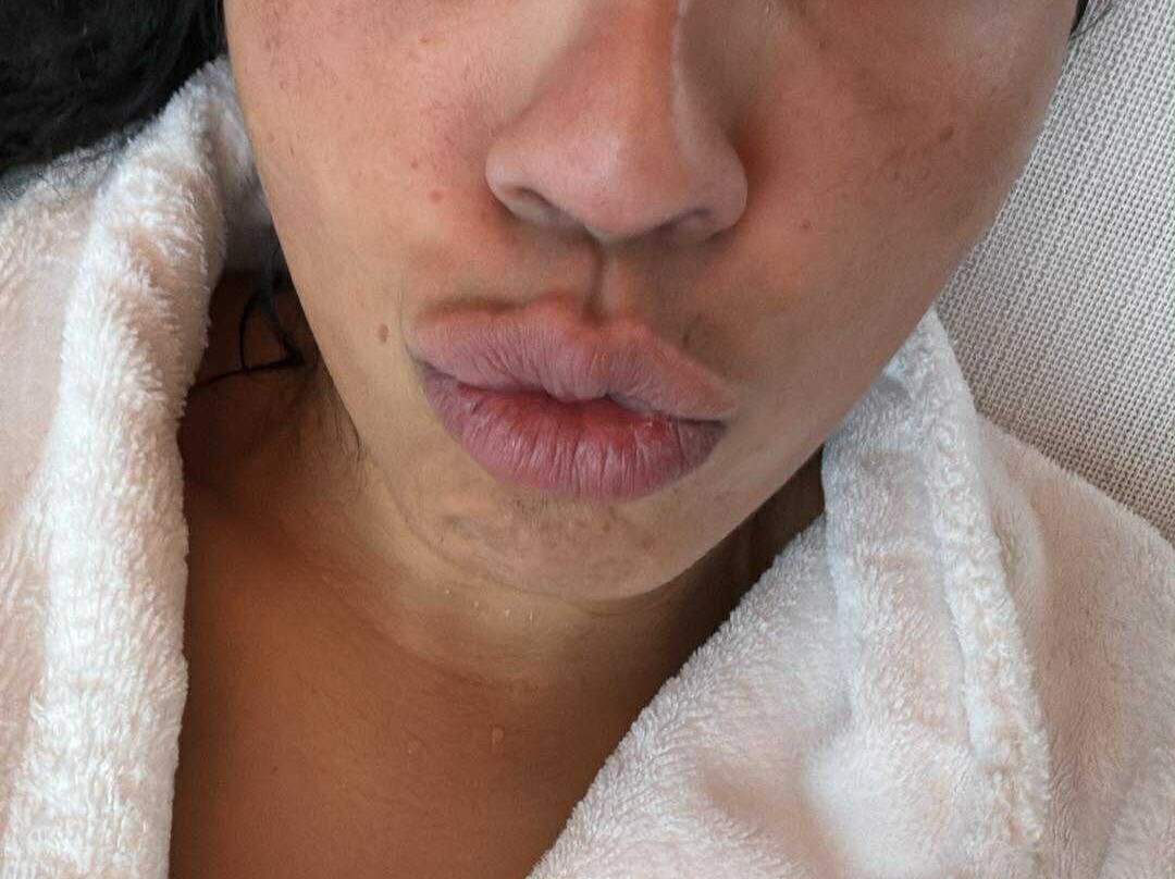 Hotel Prätschli主图