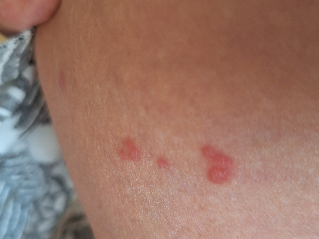 阿尔巴特罗斯酒店主图