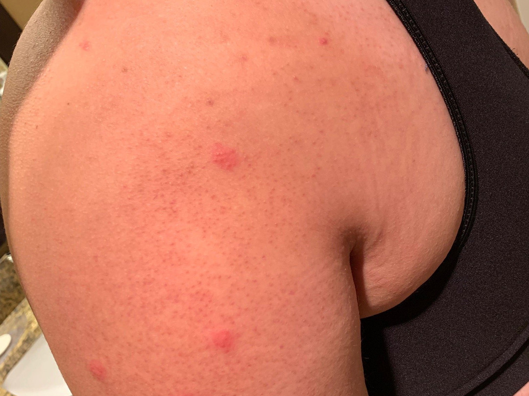 Comfort Suites Milwaukee Airport主图