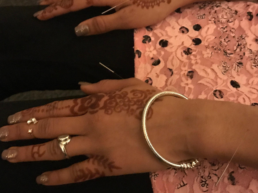 Community Acupuncture Project of Burien-Burien必去景点