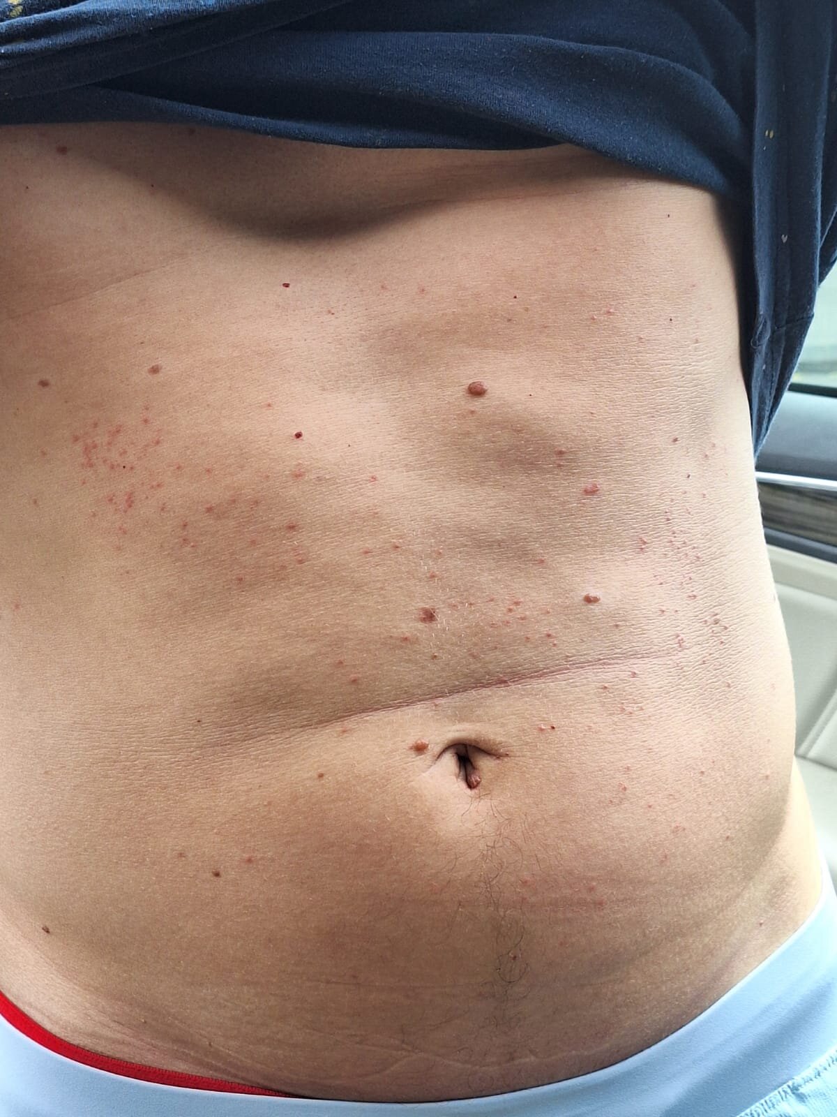 Hotel Malabou Beach-官方