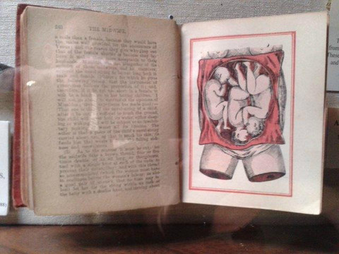 Old Operating Theatre Museum and Herb Garret-伦敦必去景点