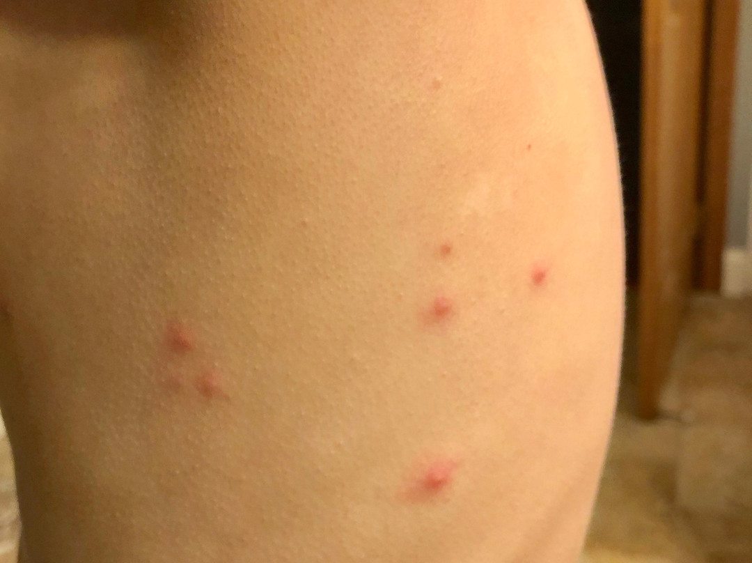 Teewinot Lodge主图