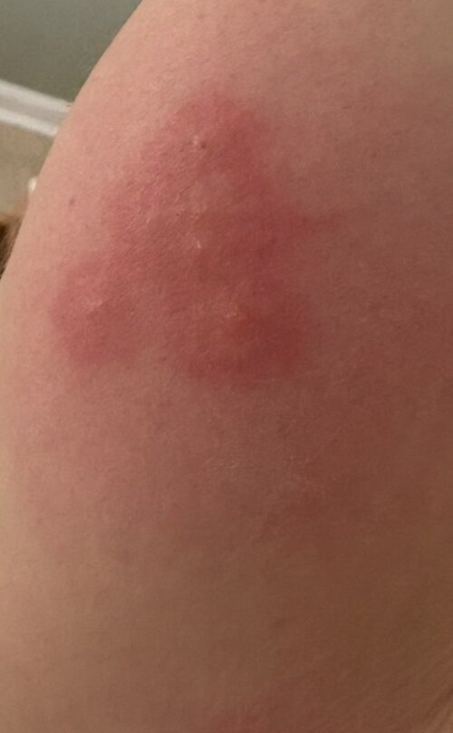 曼切斯特机场希尔顿惠庭套房酒店主图