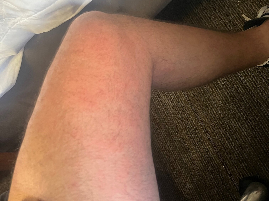 卡拉巴萨斯美好夜间旅馆主图