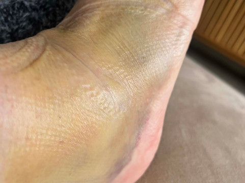 一格思顿乡村俱乐部酒店主图