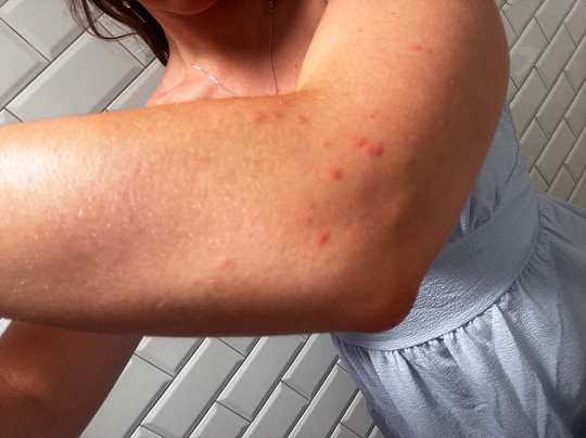 Residenza La Campana主图