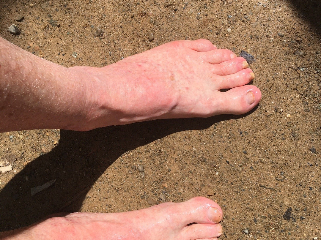 Sungai Moroli Fish Massage-拉瑙必去景点