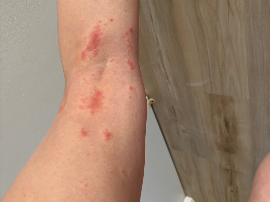 The Mountain Club on Loon主图