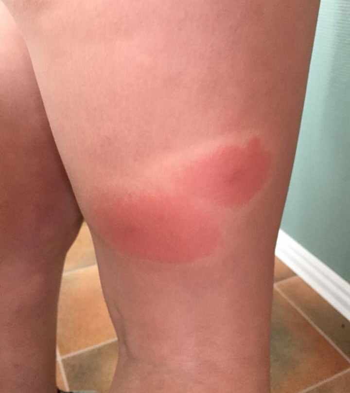 Esperides Beach Hotel Apartments主图