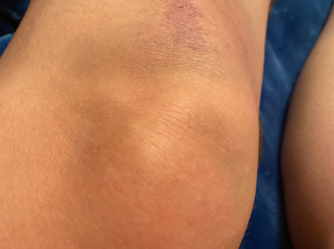 Alpine Slide at Magic Mountain-大熊湖必去景点