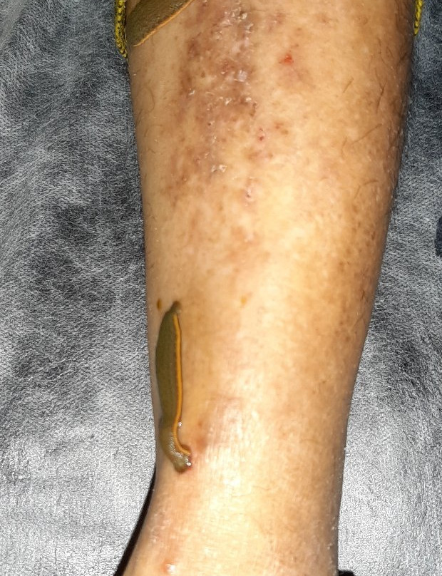 Yashraj Clinic-加兰古特必去景点