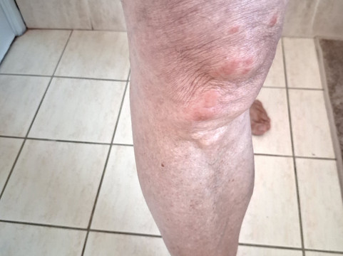 彭赫斯特酒店主图