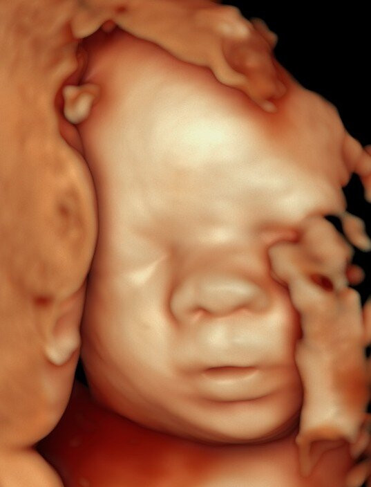 4D Baby Studio LLC-Anthem必去景点