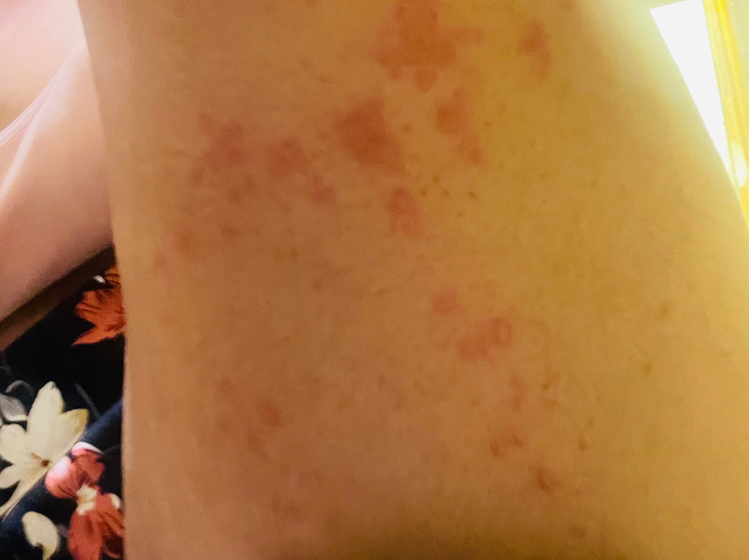 巴厘岛库塔广场智选假日酒店主图