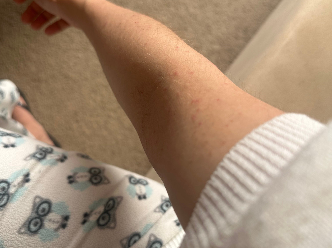 宜必思埃尔加迪达酒店主图