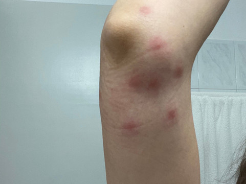 阿尔曲翁提克安杰卢酒店主图