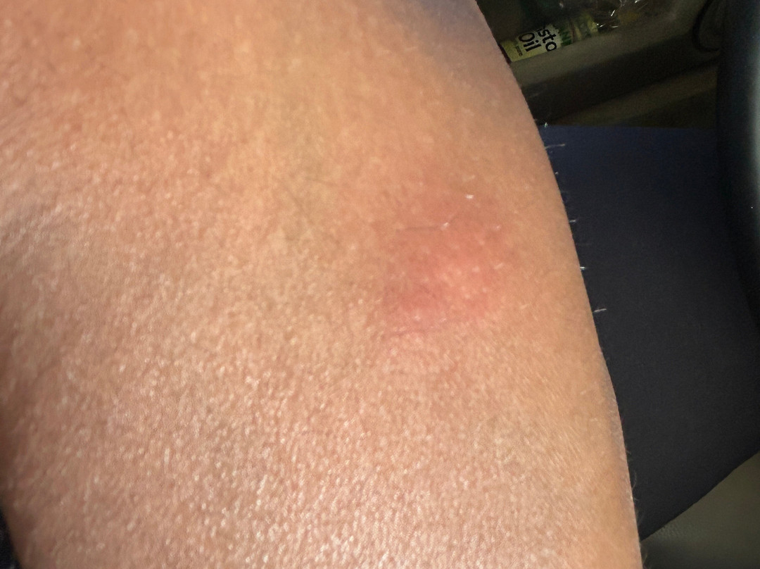 哥伦比亚东北/杰克森堡拉昆塔温德姆酒店主图