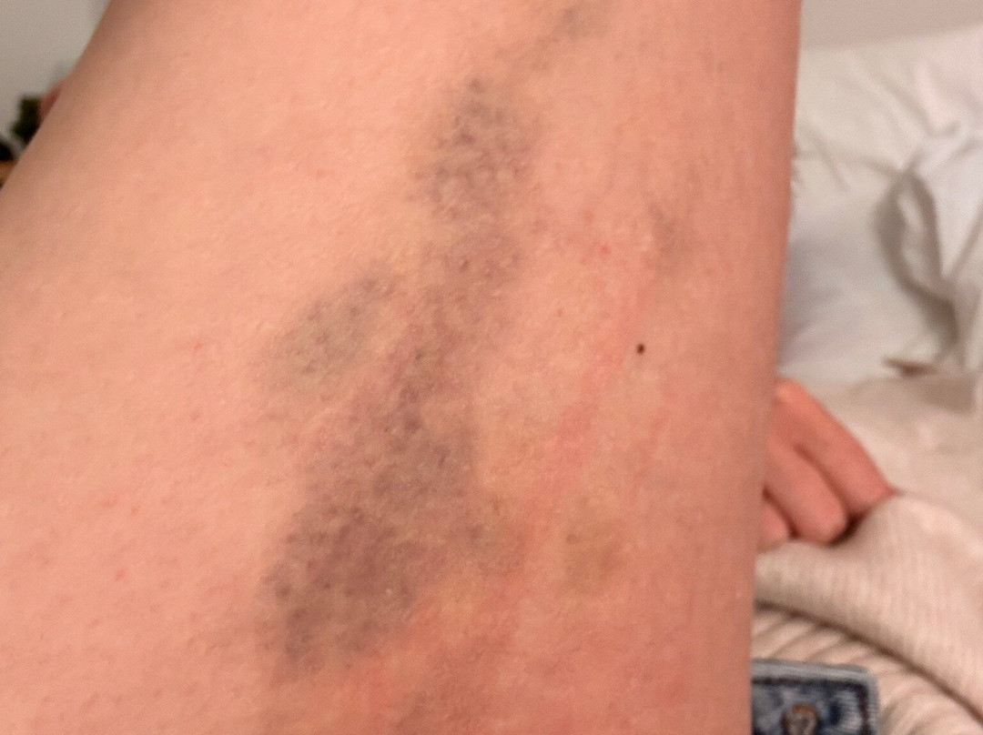 Golden Spa Relax Blloku-地拉那必去景点