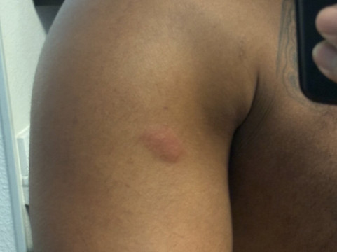 智选假日套房酒店阿比林主图