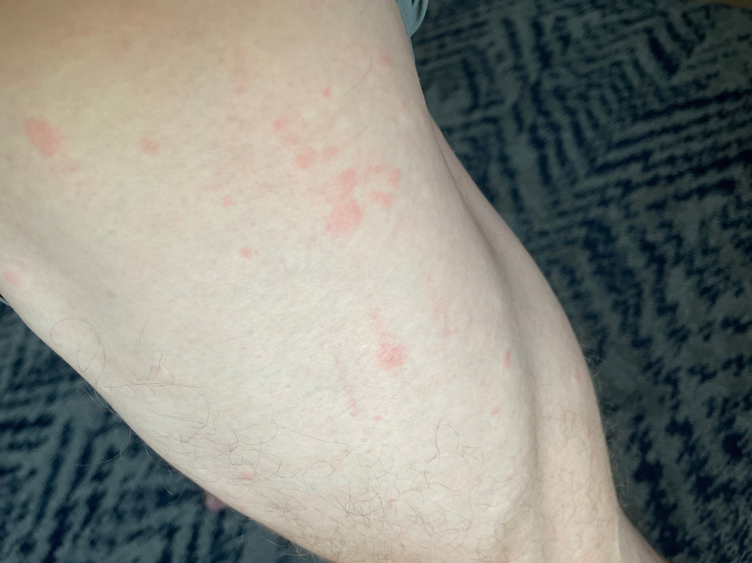 尚佩恩乌班纳大学区烛木套房酒店主图