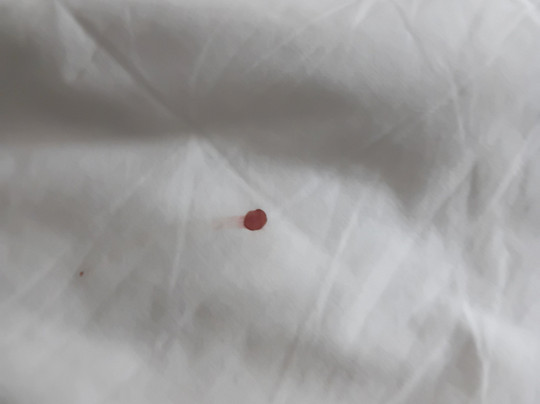 Super 8 by Wyndham Lees Summit主图