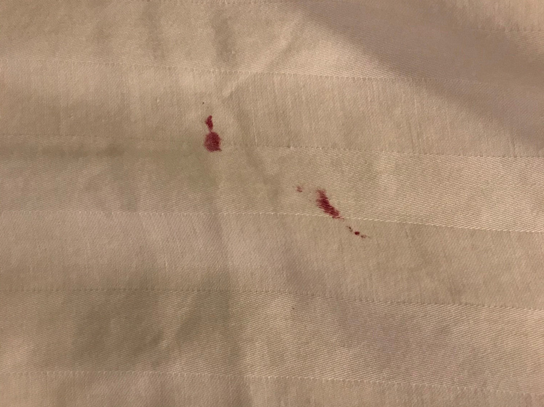 Best Western Abilene Inn & Suites主图