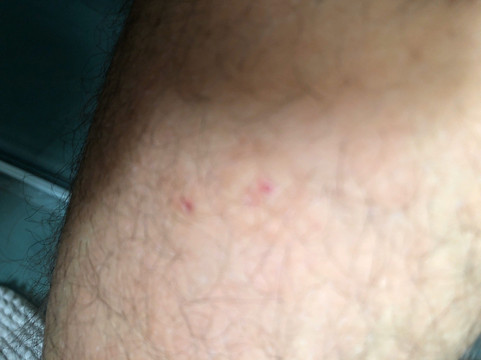 Kronenhotel Seefeld主图