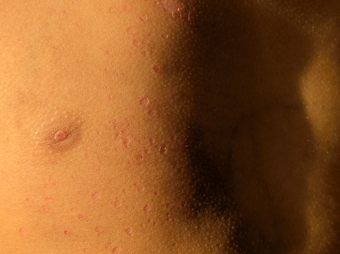 卡萨龙度假村和水疗中心主图