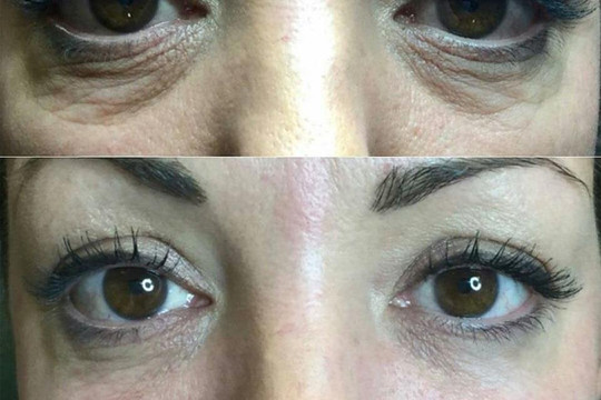 Noire Luxury Spa-Saint Clair必去景点