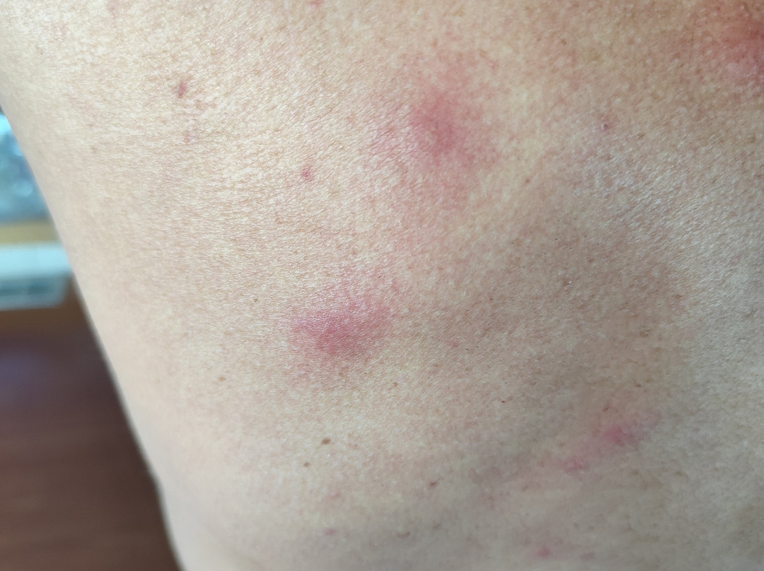 埃里卡酒店主图