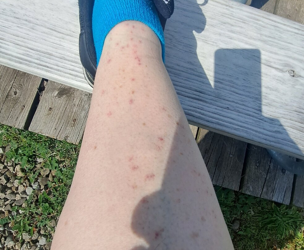 布拉德福德智选假日酒店主图