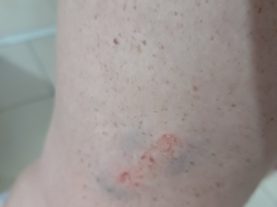 Bar E Restaurant Da Lagosta-Pitimbu必去景点